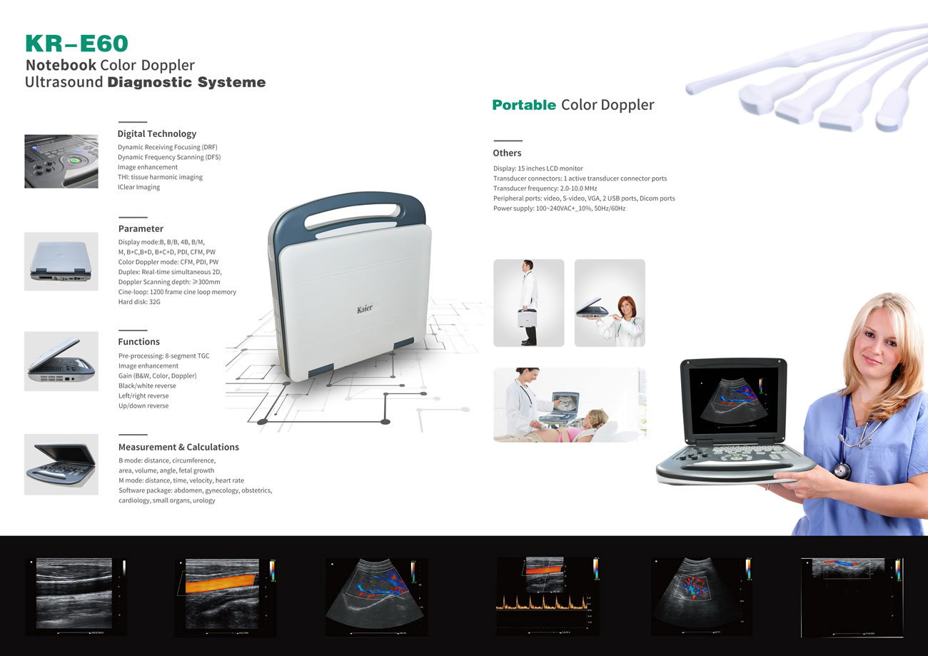 KR-E60便攜式彩超機